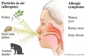 allergic-rhinitis1